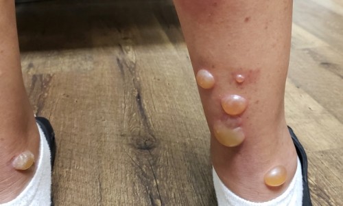 怀孕8个月可以吃瑶柱虾粥吗网—知名的孕妇能吃瑶柱煲粥吗网站,分享孕妇能吃瑶柱煲粥吗知识